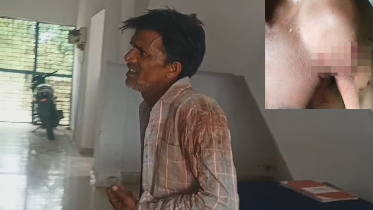 Leopard Attackes Man In Jabalpur Forest, Leaves Deep Fang-Marks On Shoulder & Back

